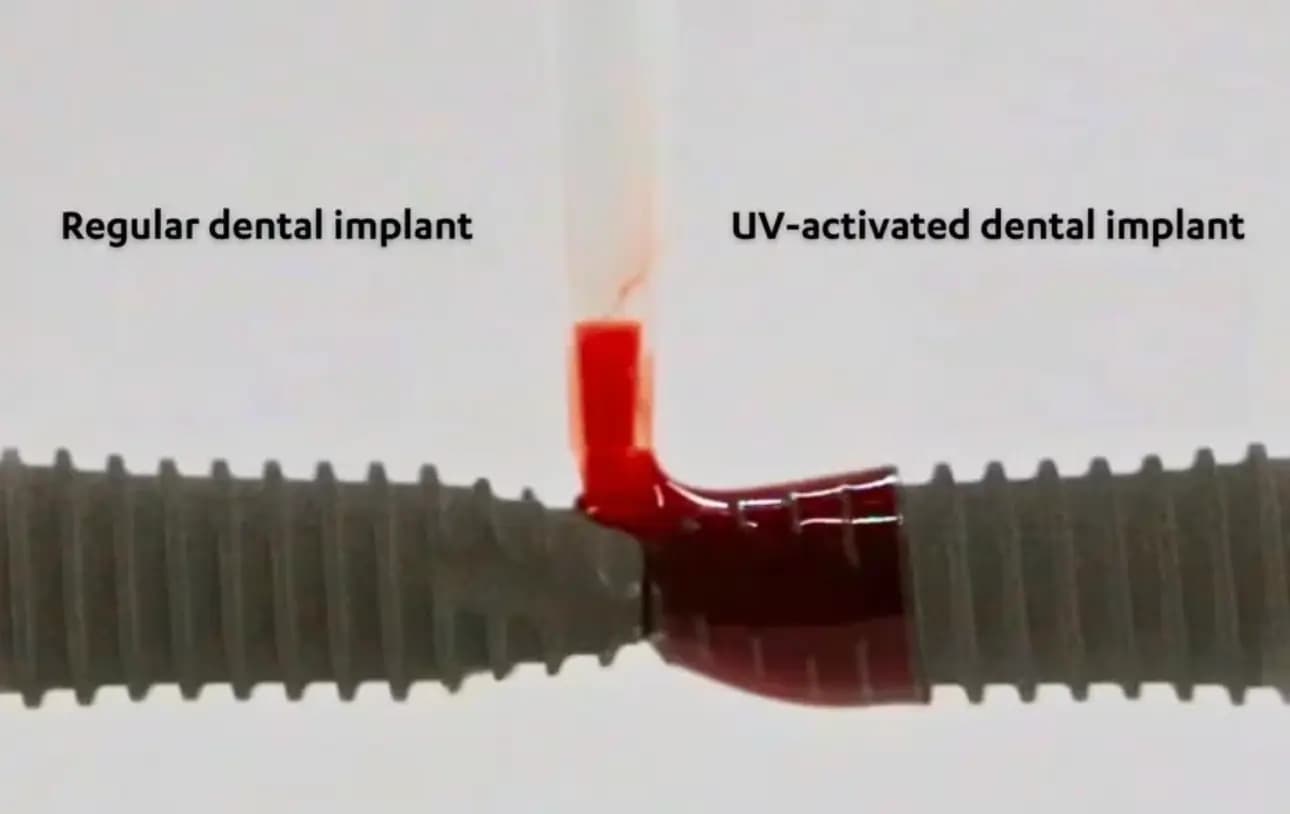 UV-treated titanium implant vs untreated implant — bone integration comparison from Dr. Ogawa's UCLA photofunctionalization research