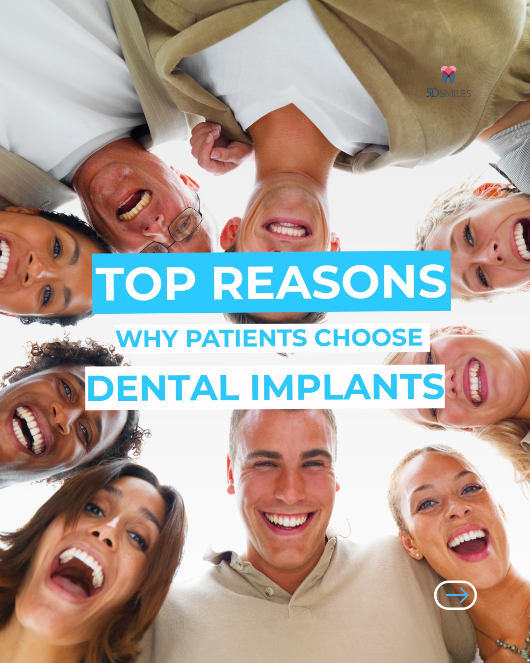 Before and after dental implant case — 5D Smiles Downey CA